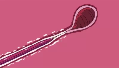 [自行打包] 【重口】【触手】2D动画 Watch [芋畑] ちびむん 有码版 [1V+126M][百度盘]